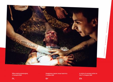 photo from the exhibition Belarus. Road to freedom. victim of protest. a man lies on the ground, wounded on the face.